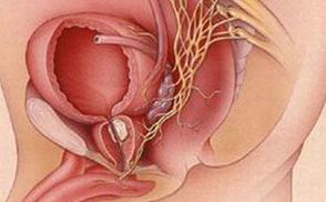 男人前列腺增生治疗