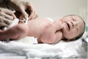 新生婴儿肚脐护理有哪些