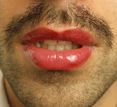 男性可以从唇部看出健康状况