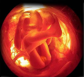 胎儿停止发育有什么症状