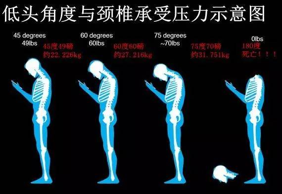 低头玩手机=脖子挂50斤重物?看手机的你要注意了