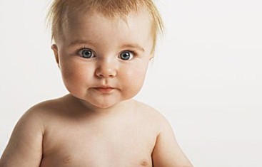 婴儿湿疹和痱子的区别