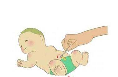 新生儿脐带护理用什么方法