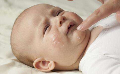 婴儿湿疹的护理方法