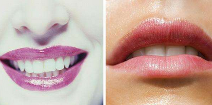 嘴唇发紫是什么原因