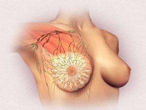 乳腺增生的症状及原因有哪些