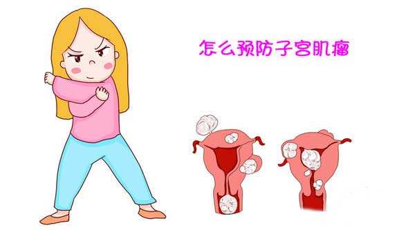 怎样预防子宫肌瘤？女性朋友们可要注意啦！