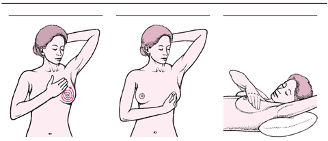 女性该如何预防乳腺癌？赶紧改掉这些不好的习惯吧！